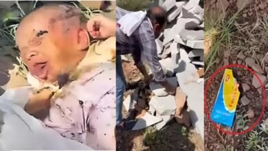 Cruel Mother: A heartbreaking incident...attempt to kill a 15-day-old newborn...stone in the mouth and Feviquick on the lips...see pictures here