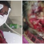 Terror of Bears: Manendragarh Breaking...! Bears attack 9 month pregnant woman...People with weak heart should not watch the video