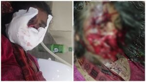 Terror of Bears: Manendragarh Breaking...! Bears attack 9 month pregnant woman...People with weak heart should not watch the video