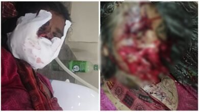 Terror of Bears: Manendragarh Breaking...! Bears attack 9 month pregnant woman...People with weak heart should not watch the video