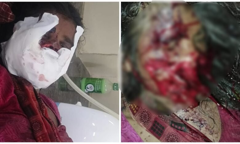Terror of Bears: Manendragarh Breaking...! Bears attack 9 month pregnant woman...People with weak heart should not watch the video