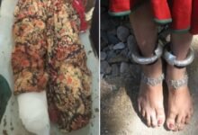 Brutality: The height of brutality! A man took a woman to the forest on the pretext of offering her a job, cut off both her legs, and stole 1.5 kg of silver bracelets. Watch the video here.