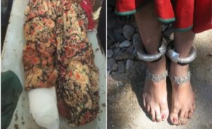 Brutality: The height of brutality! A man took a woman to the forest on the pretext of offering her a job, cut off both her legs, and stole 1.5 kg of silver bracelets. Watch the video here.