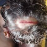 Dispute Between Players: A ruckus over the trophy at the closing ceremony of the 25th state-level school sports competition, an attack with a hockey stick, and a player received 14 stitches on his head.