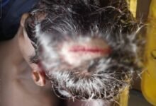 Dispute Between Players: A ruckus over the trophy at the closing ceremony of the 25th state-level school sports competition, an attack with a hockey stick, and a player received 14 stitches on his head.