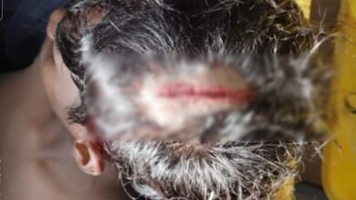 Dispute Between Players: A ruckus over the trophy at the closing ceremony of the 25th state-level school sports competition, an attack with a hockey stick, and a player received 14 stitches on his head.