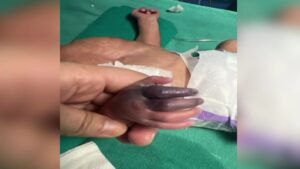 Private Nursing Homes: Negligence of doctors and staff at the nursing home! An infant was given an injection incorrectly...now the newborn's hand will have to be amputated.