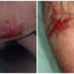 Molestation of a Girl: A knife attack in Raipur amid high alert! A young woman was molested... When her brother tried to stop her, she attacked him with a knife... Watch the video here.