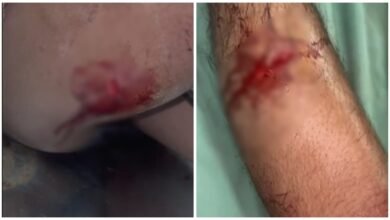 Molestation of a Girl: A knife attack in Raipur amid high alert! A young woman was molested... When her brother tried to stop her, she attacked him with a knife... Watch the video here.