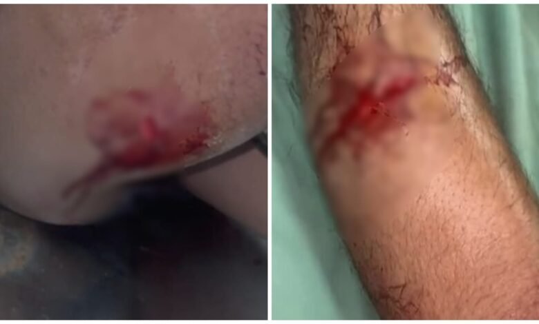 Molestation of a Girl: A knife attack in Raipur amid high alert! A young woman was molested... When her brother tried to stop her, she attacked him with a knife... Watch the video here.