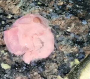 Steak in Syrup: Pregnant woman receives contaminated medicine! Pieces of meat in calcium syrup... batch sealed... samples sent to lab