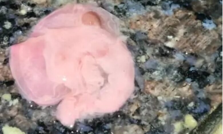 Steak in Syrup: Pregnant woman receives contaminated medicine! Pieces of meat in calcium syrup... batch sealed... samples sent to lab