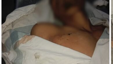 Knife Attack: First incident after the implementation of the commissionerate system in Raipur...A young man was stabbed to death in Samta Colony.