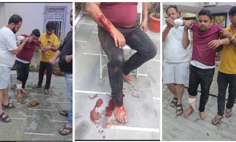 Pitbull Dog Bite Case: Young man seriously injured in a pitbull attack! The dog severely mauled the hand of a man who had come to collect payment.