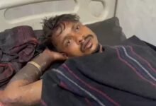 CG Crime: Girlfriend calls boyfriend...! Brother burns her with petrol...condition critical...hospitalized