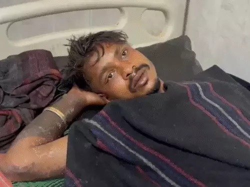 CG Crime: Girlfriend calls boyfriend...! Brother burns her with petrol...condition critical...hospitalized