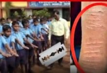 Child Safety: Big news from Dhamtari...! 35 children cut their hands with blades... The department and administration are shocked to learn the reason.