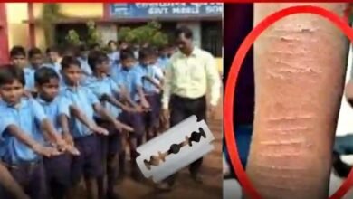 Child Safety: Big news from Dhamtari...! 35 children cut their hands with blades... The department and administration are shocked to learn the reason.