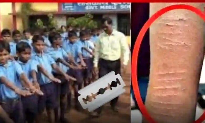 Child Safety: Big news from Dhamtari...! 35 children cut their hands with blades... The department and administration are shocked to learn the reason.