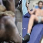 Iron Plant Accident: A major accident occurred at the Nova Sponge Iron Plant in Bilaspur...! Four workers were seriously burned when boiling iron fell on them... Watch the video here.
