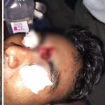 Protest Violence: Unrest in Sakti... Outrage Erupts Following Child's Death... Attack with Bricks and Stones; Constable Sustains Head Injury.