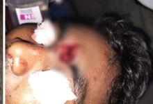 Protest Violence: Unrest in Sakti... Outrage Erupts Following Child's Death... Attack with Bricks and Stones; Constable Sustains Head Injury.