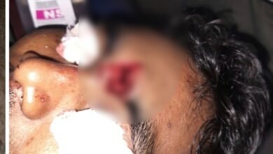 Protest Violence: Unrest in Sakti... Outrage Erupts Following Child's Death... Attack with Bricks and Stones; Constable Sustains Head Injury.