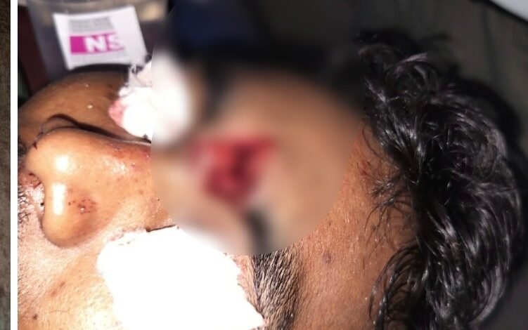 Protest Violence: Unrest in Sakti... Outrage Erupts Following Child's Death... Attack with Bricks and Stones; Constable Sustains Head Injury.