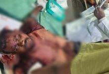 Train Accident: Major Train Mishap in Raipur! Blood-Soaked Youth Found Near Platform—One Arm Severed from Body.