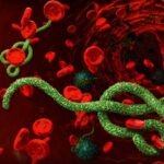 Ebola Alert: Panic Grips Chhattisgarh Amidst Fears of Ebola Outbreak! High Alert at Airports... Health Department Issues Strict Directives.
