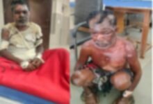 Domestic Violence: Horrific Incident in Chhattisgarh! Wife Sets Husband Ablaze After Being Stopped from Brewing Liquor—Condition Critical.