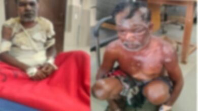 Domestic Violence: Horrific Incident in Chhattisgarh! Wife Sets Husband Ablaze After Being Stopped from Brewing Liquor—Condition Critical.
