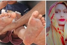 Child Abuse: Driven by a craving for intoxicants, a mother inflicted a horrific punishment on her 6-year-old son! She gave him ₹20 to fetch *gutkha*; when he spent ₹5 of it, she branded the soles of his feet with a hot knife, locked him in the room, and left for a birthday party.