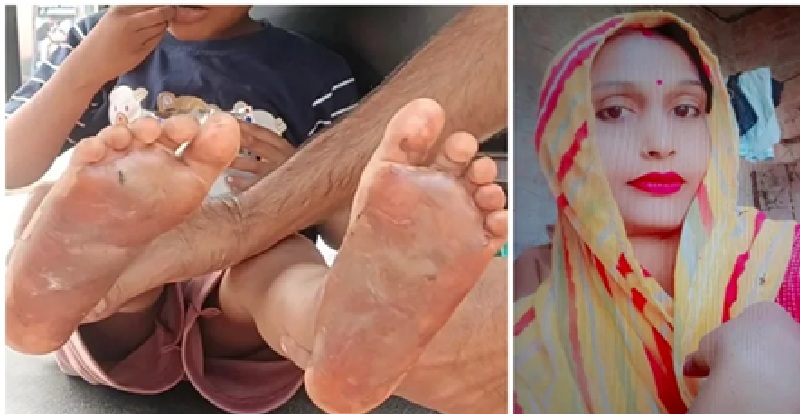 Child Abuse: Driven by a craving for intoxicants, a mother inflicted a horrific punishment on her 6-year-old son! She gave him ₹20 to fetch *gutkha*; when he spent ₹5 of it, she branded the soles of his feet with a hot knife, locked him in the room, and left for a birthday party.
