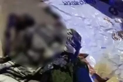 Raipur Crime News: Attempt to set a woman on fire by dousing her with petrol in Raipur! Admitted in critical condition; accused absconding; search intensified using CCTV footage.