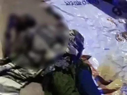 Raipur Crime News: Attempt to set a woman on fire by dousing her with petrol in Raipur! Admitted in critical condition; accused absconding; search intensified using CCTV footage.